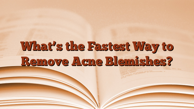 What’s the Fastest Way to Remove Acne Blemishes?